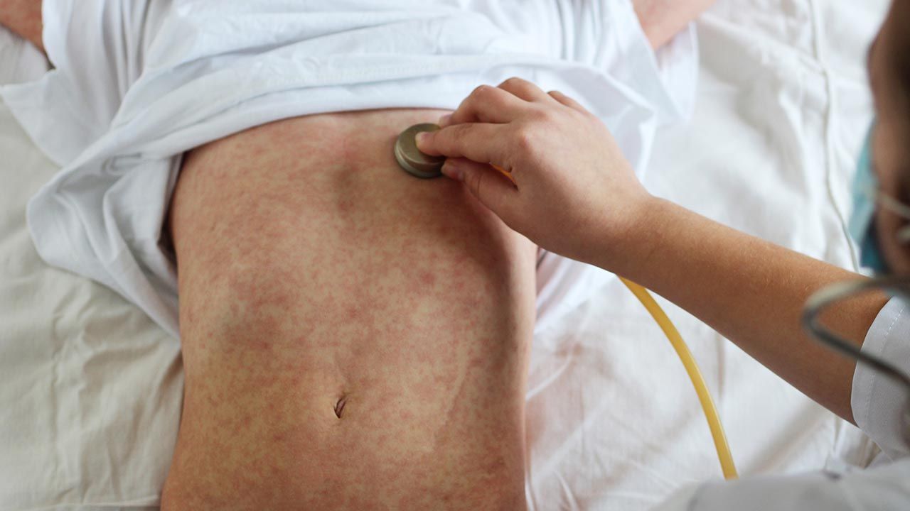 W wielu krajach kampanie szczepień zostały wstrzymane w pierwszych miesiącach 2020 roku (fot. Shutterstock/fotohay) W wielu krajach kampanie szczepień zostały wstrzymane w pierwszych miesiącach 2020 roku (fot. Shutterstock/fotohay)