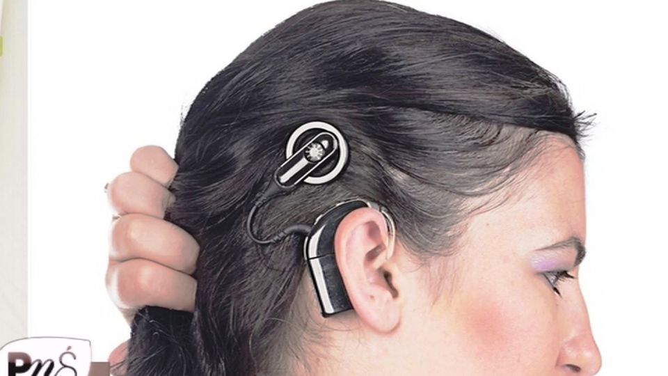 Квадробика уши. Аппарат Cochlear кохлеарный. Слуховой аппарат Cochlear 7. Кохлеарный имплант кохлеар.