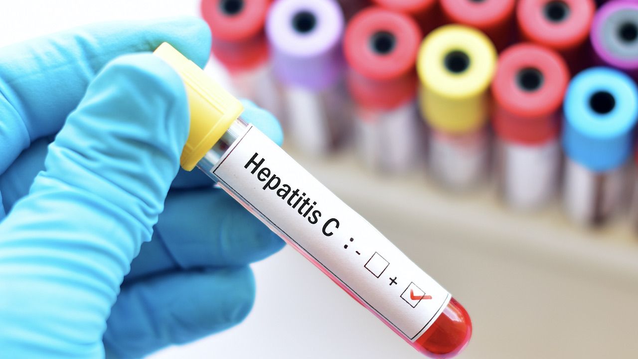 Pandemia COVID–19 odsunęła na bok prace nad wieloma obszarami badań medycznych (fot. Shutterstock/J.Ontakrai) Pandemia COVID–19 odsunęła na bok prace nad wieloma obszarami badań medycznych (fot. Shutterstock/J.Ontakrai)