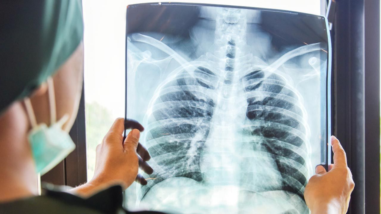 Wyszkoleni w Polsce lekarze dokonali udanego przeszczepu (fot. Shutterstock/ Autor: Studio4dich) Wyszkoleni w Polsce lekarze dokonali udanego przeszczepu (fot. Shutterstock/ Autor: Studio4dich)