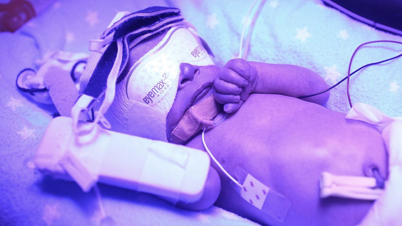 Fototerapia może w sposób bezpieczny wspomagać standardowe metody leczenia (fot. J.Polixenni Brankin/Getty Images) Fototerapia może w sposób bezpieczny wspomagać standardowe metody leczenia (fot. J.Polixenni Brankin/Getty Images)